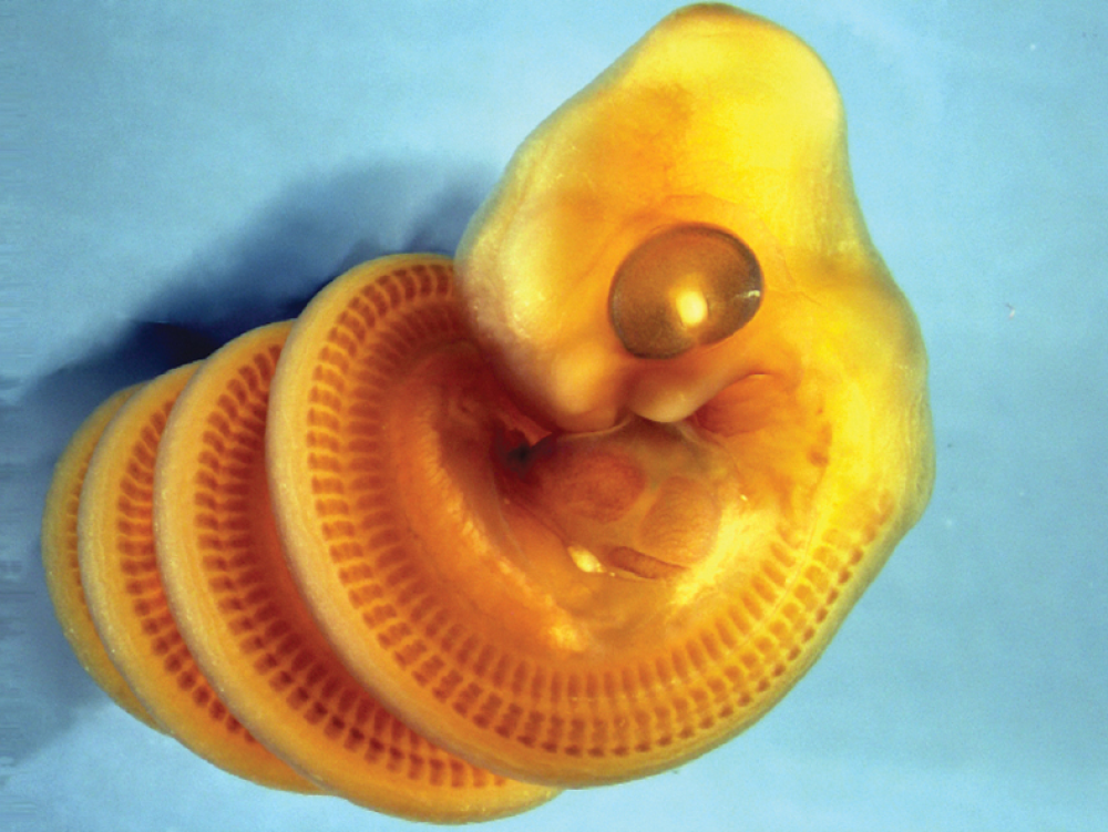 An embryo of Cape house snake ( Boaedon capensis) stained to show developing muscle blocks in the trunk. The embryo shows right- handed coiling An embryo of Cape house snake ( Boaedon capensis) stained to show developing muscle blocks in the trunk. The embryo shows right- handed coiling